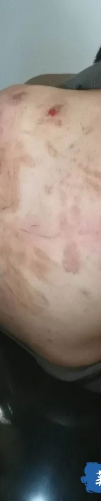 遭绑架勒索20万，暴打后卖去网赌，获救仅能泡面充饥